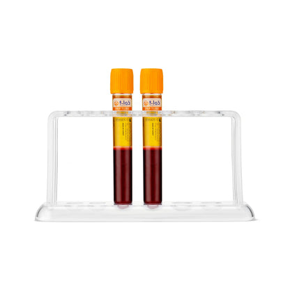 PRP Kit T-Lab – Професионален комплект за приготвяне на автоложна плазма, предназначен за естетична и дерматологична терапия. Осигурява лесно, безопасно и бързо извличане на богата на тромбоцити плазма (PRP) за стимулиране на регенерацията на кожата, подмладяване и ускоряване на възстановителните процеси. Съвместим с повечето стандартни центрофуги.